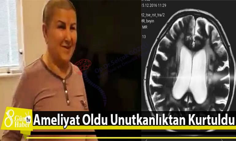 Op. Dr. Selçuk Gözcü - Beyin ve Sinir Hastalıkları Cerrahisi Uzmanı