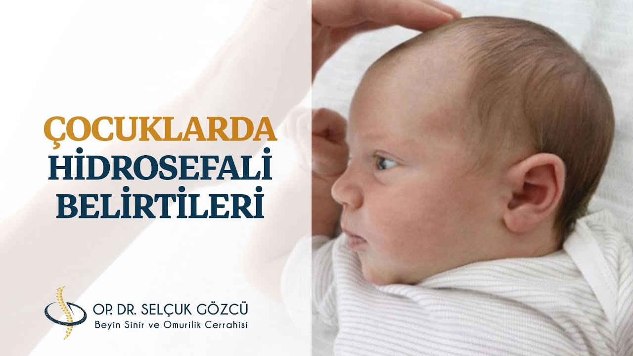Op. Dr. Selçuk Gözcü - Beyin ve Sinir Hastalıkları Cerrahisi Uzmanı